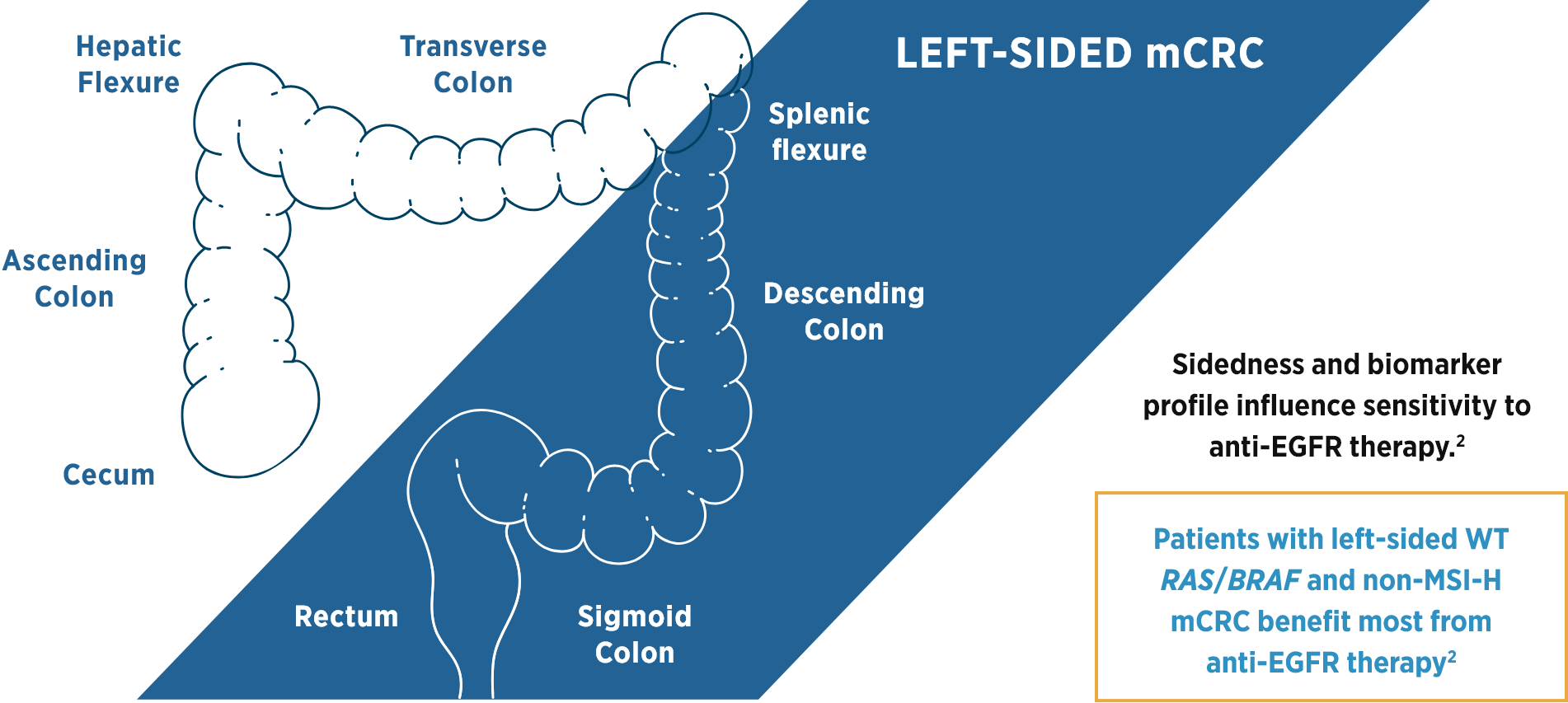 Diagram of left-sided tumors for mCRC patients