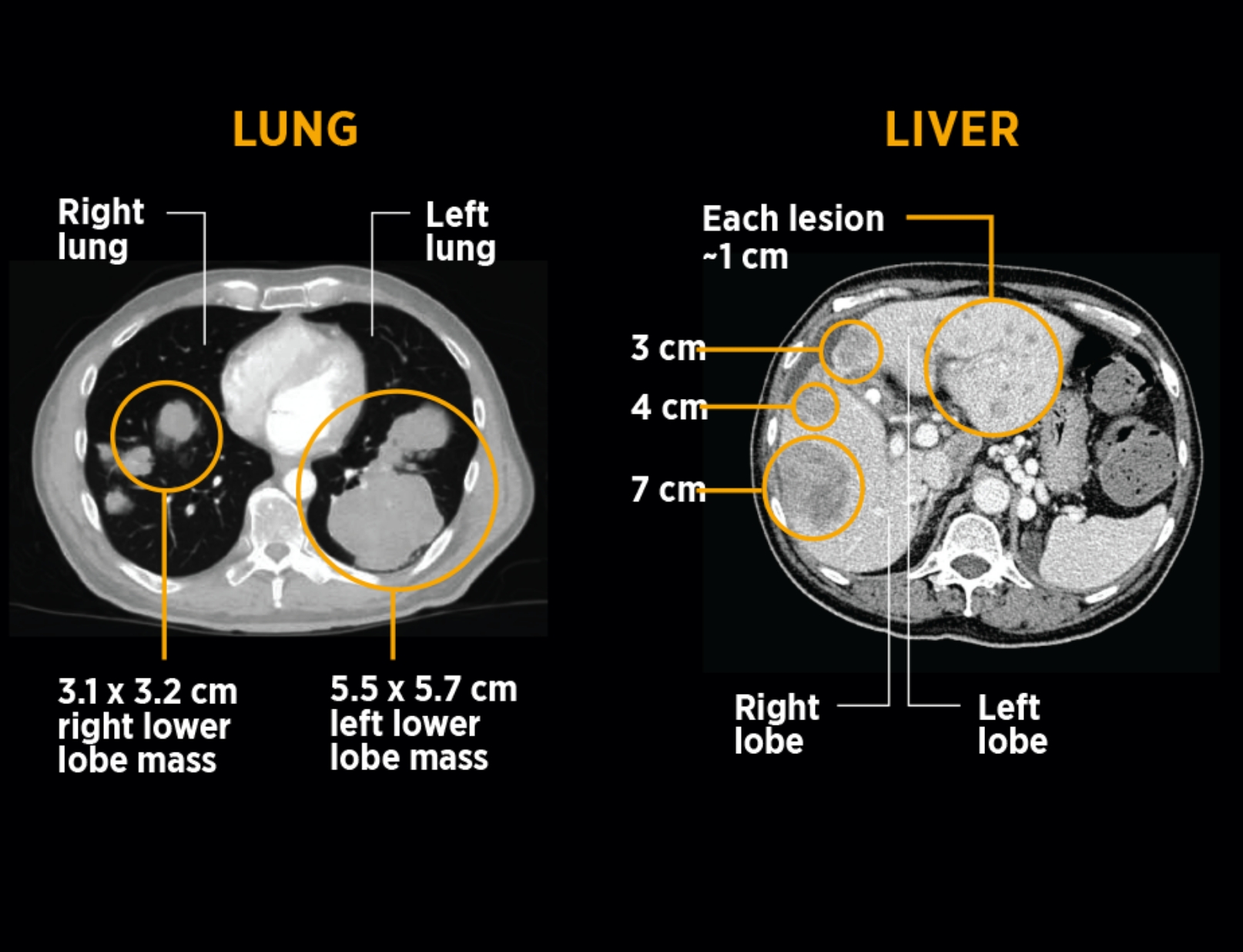 Right and left sides of lung and liver