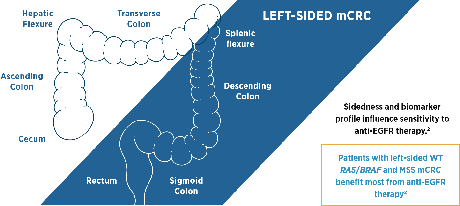Diagram of left-sided tumors for mCRC patients